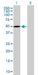 MASP1 Antibody in Western Blot (WB)