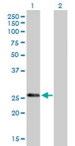 KLK7 Antibody in Western Blot (WB)