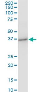 PRSS8 Antibody in Western Blot (WB)