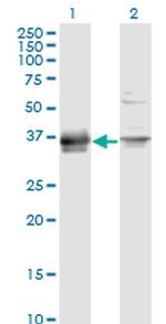 PRSS8 Antibody in Western Blot (WB)