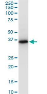 PRSS8 Antibody in Western Blot (WB)