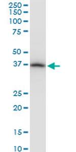 PRSS8 Antibody in Western Blot (WB)