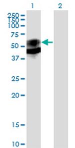 PSAP Antibody in Western Blot (WB)