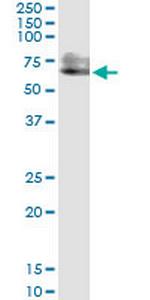 PSAP Antibody in Western Blot (WB)