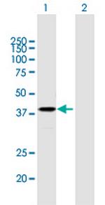 PSG2 Antibody in Western Blot (WB)