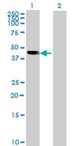 PSG5 Antibody in Western Blot (WB)