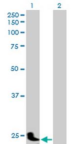 PSG11 Antibody in Western Blot (WB)