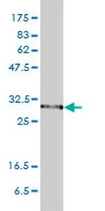 PSMA1 Antibody in Western Blot (WB)