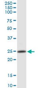 PSMB4 Antibody in Western Blot (WB)