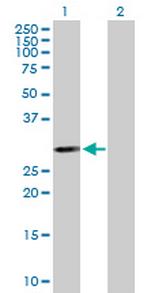 PSMB5 Antibody in Western Blot (WB)