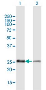 PSMB5 Antibody in Western Blot (WB)