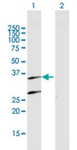 PSMB7 Antibody in Western Blot (WB)