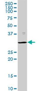 PSMB8 Antibody in Western Blot (WB)