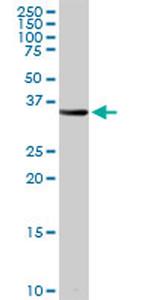 PSMB8 Antibody in Western Blot (WB)