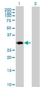 PSMB8 Antibody in Western Blot (WB)