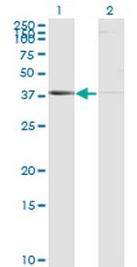 PSMB8 Antibody in Western Blot (WB)