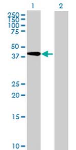 PSMC4 Antibody in Western Blot (WB)