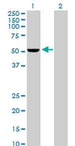 PSMD5 Antibody in Western Blot (WB)