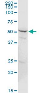 PSMD5 Antibody in Western Blot (WB)