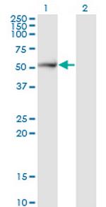 PSMD5 Antibody in Western Blot (WB)