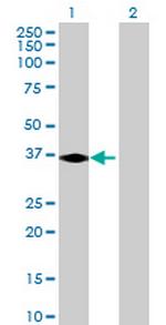 PSMD7 Antibody in Western Blot (WB)