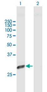 PSMD9 Antibody in Western Blot (WB)