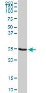 PSMD9 Antibody in Western Blot (WB)