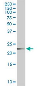 PSMD10 Antibody in Western Blot (WB)