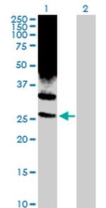 PSMD10 Antibody in Western Blot (WB)