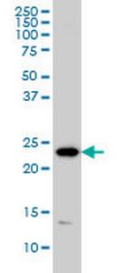 PSMD10 Antibody in Western Blot (WB)