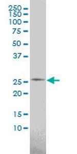 PSPH Antibody in Western Blot (WB)