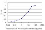 PSPH Antibody in ELISA (ELISA)