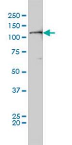 PTK2 Antibody in Western Blot (WB)