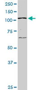 PTK2 Antibody in Western Blot (WB)