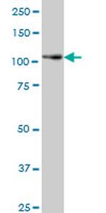 PTK7 Antibody in Western Blot (WB)