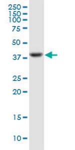 PTX3 Antibody in Western Blot (WB)