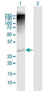 RAD1 Antibody in Western Blot (WB)