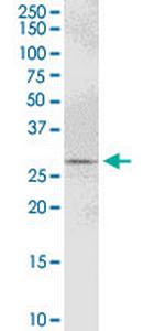 PYCR1 Antibody in Western Blot (WB)