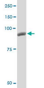 PYGM Antibody in Western Blot (WB)