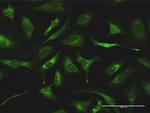 QARS Antibody in Immunocytochemistry (ICC/IF)