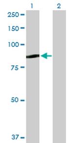 QARS Antibody in Western Blot (WB)