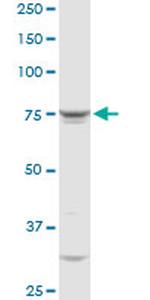 QARS Antibody in Western Blot (WB)