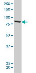 QARS Antibody in Western Blot (WB)