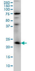 RAB3A Antibody in Western Blot (WB)