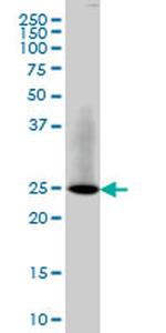 RAB3B Antibody in Western Blot (WB)