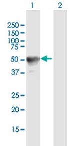 RAB3IL1 Antibody in Western Blot (WB)