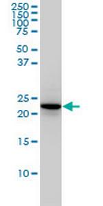 RAB4A Antibody in Western Blot (WB)