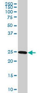 RAB27A Antibody in Western Blot (WB)