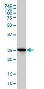 RAB27A Antibody in Western Blot (WB)