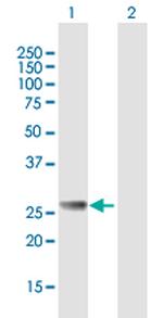 RAB27B Antibody in Western Blot (WB)